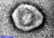 virus_de_la_grippe_vue_au_microscope_electronique_en_transmission.jpg