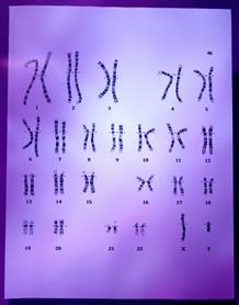 Caryotype d'une cellule humaine, par hybridation en fluorescence.