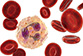 Les neutrophiles immatures participent à l’inflammation chronique accompagnant l’infection par le VIH