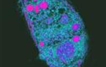 Comment le parasite de la toxoplasmose détourne la machinerie des cellules