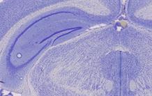 Alzheimer : la puissance de l’histologie 3D pour évaluer les médicaments