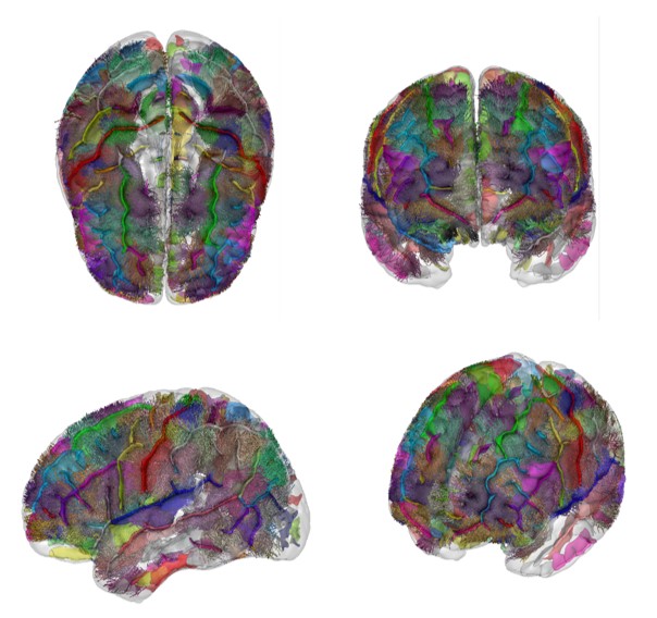 Visualisation en 3D des faisceaux « courte distance » © Miguel Guevara
