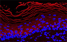 Skin graft: a new molecular target for activating stem cells