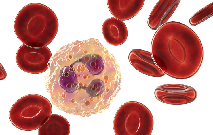 Les neutrophiles immatures participent à l’inflammation chronique accompagnant l’infection par le VIH 