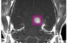 Des agents d’imagerie IRM qui sondent le cerveau