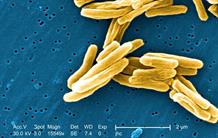 European research gets organised against tuberculosis