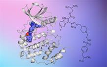 New anti-cancer treatment targeting a protein kinase