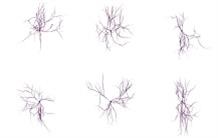 Quantifier la morphologie des cellules du cerveau par résonance magnétique in vivo