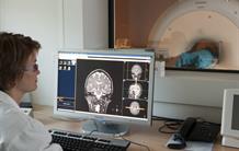 Improve MRI medical diagnosis and reduce the cost of treatment