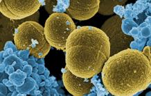 Targeting metals to fight Staphylococcus aureus
