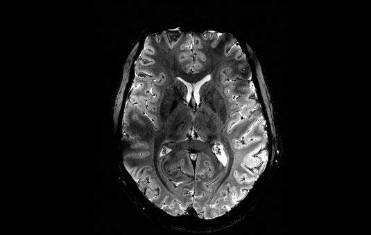 A world premiere: the living brain imaged with unrivaled clarity thanks to the world’s most powerful MRI machine
