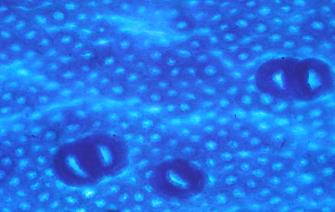 Premiers résultats de l’exposition orale aux nanoparticules de dioxyde de titane
