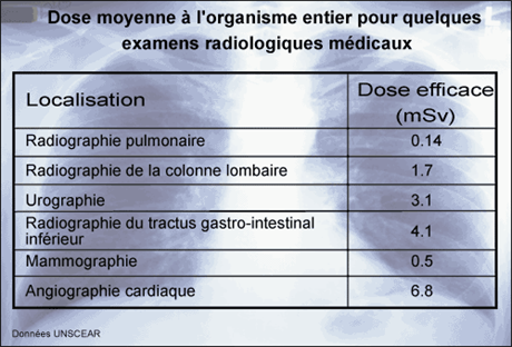 Expositions liées aux examens radiologiques médicaux