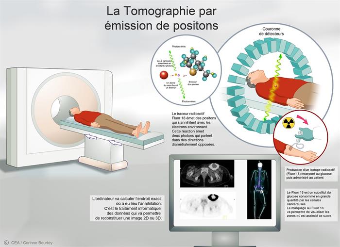 La tomographie par émission de positons