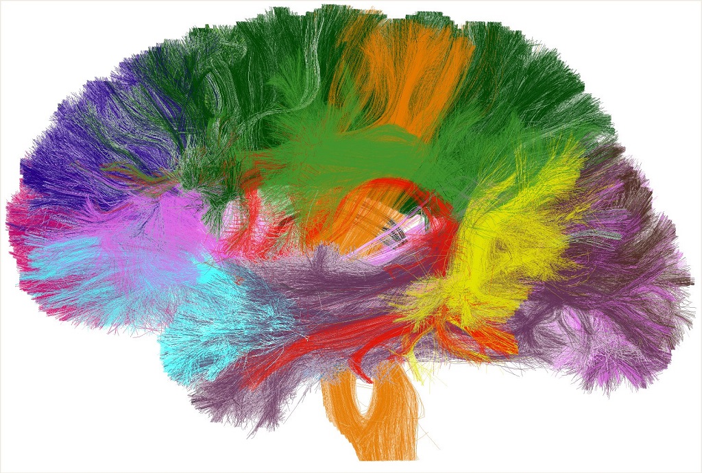 Représentation de 38 faisceaux longs de la substance blanche cérébrale (chaque couleur code 1 faisceau)