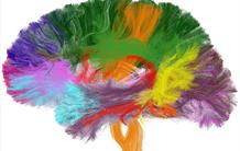 Le CEA célèbre la Semaine du cerveau avec de nouvelles ressources et des événements 