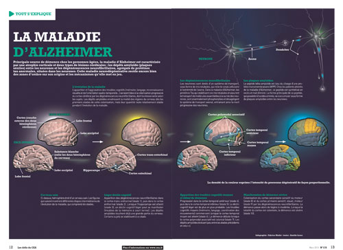 Infographie sur la maladie d'Alzheimer
