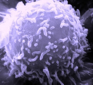 Un lymphocyte vu par un microscope électronique à balayage