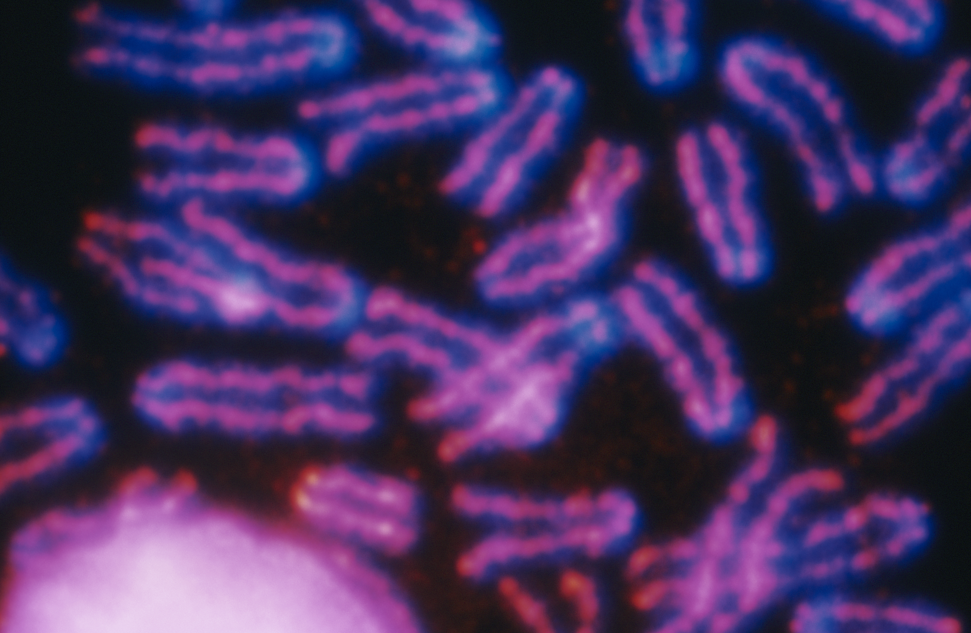 Recherche d'anomalies chromosomiques par microscopie à fluorescence. 