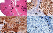 Comment la protéine NLRP7 contribue-t-elle au camouflage de la cellule tumorale placentaire ?