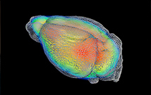 L’imagerie TEP éclaire l’action de la kétamine sur la dépression