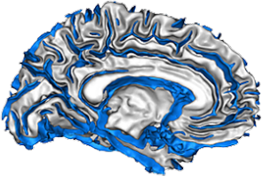 « Déchiffrer le plissement cortical » : nouvelle avancée