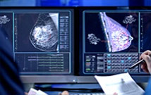 Cancer du sein : épigénome et résistance aux chimiothérapies