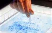 Mieux connaître les maladies lysosomales