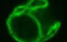 L’algue verte dévoile son enzyme clef pour la synthèse d’oméga-3