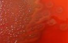 Mécanismes de survie du pneumocoque