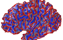 Microcéphalies : plongeon dans les plis et replis du cerveau