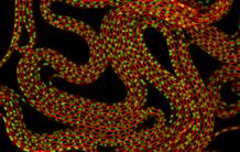 Antibiotiques : une autre stratégie pour détruire les bactéries