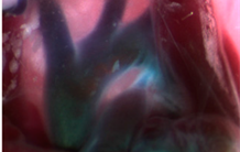 Respirer : pourquoi est-ce si difficile pour les prématurés