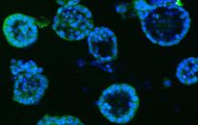 Des micro-capsules 3D pour mimer des mini-prostates