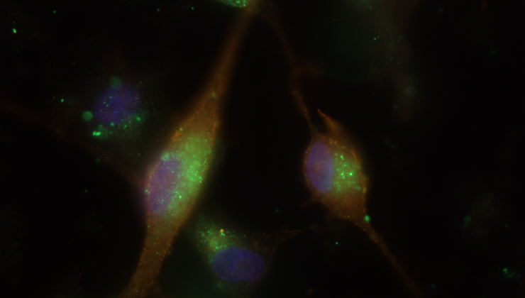 Visualisation par microscopie du ciblage des intégrines par les magnétosomes fonctionnalisés  Bleu = Noyaux cellulaires (cellules de tumeur cérébrale humaine), Orange = Intégrines, Vert = Magnétosomes fonctionnalisés internalisés dans les cellules après ciblage de l¹intégrine. © Françoise Geffroy, CEA