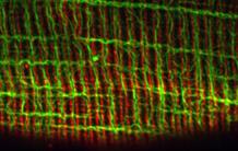 For a Better Grasp of Muscular Contraction