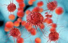 Le cancer du sein sans boule de cristal