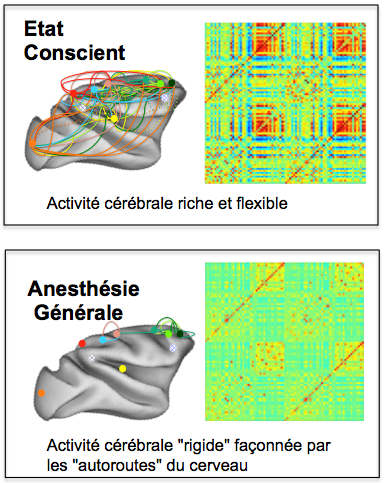 Signature cérébrale d’un cerveau conscient (figures de gauche) et d’un cerveau sous anesthésie générale (figures de droite), établie par une équipe de NeuroSpin. Les observations montrent une activité riche et flexible dans l’état « conscient » : différentes aires du cerveau peuvent être activées en phase, reliées ou non par une connexion anatomique ; si l’activité reste présente sous anesthésie générale, seule les aires connectées anatomiquement peuvent s’activer en phase, « rigidifiant » ces activations. @American Society of Anesthesiologists, 2018 © CEA