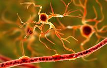 Parkinson’s disease: reduced immune support is involved