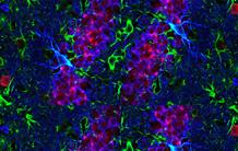 Après les neurones, Tau s’attaque aux astrocytes 