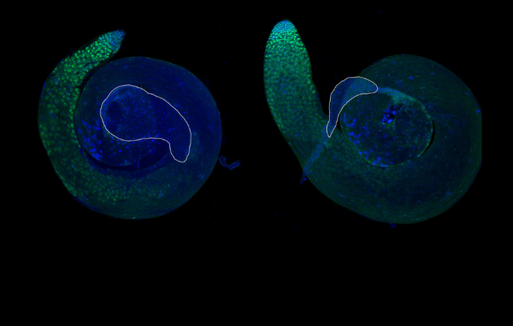 USP36 : l’enzyme qui change de mécanisme d’action selon les processus cellulaires