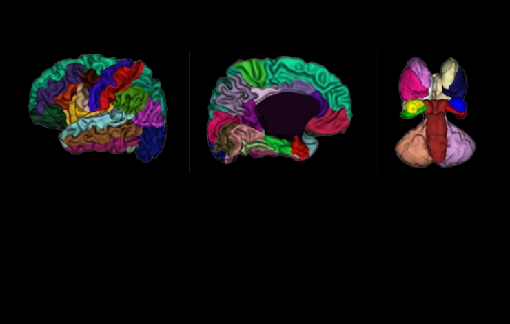 Comprendre le développement du cerveau des nourrissons grâce à l’IRM