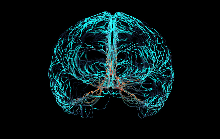 Nouvelle piste pour localiser de manière non invasive la zone épileptogène dans le cerveau