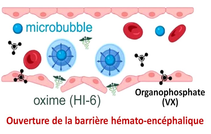 Des ultrasons pour contrer les effets cérébraux d’une exposition à un agent neurotoxique