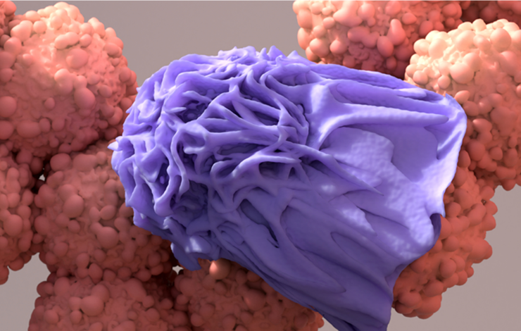 Les CAR-macrophage, une nouvelle thérapie cellulaire pour les cancers solides