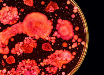 Retour sur la découverte d’une enzyme clé de la radiorésistance bactérienne