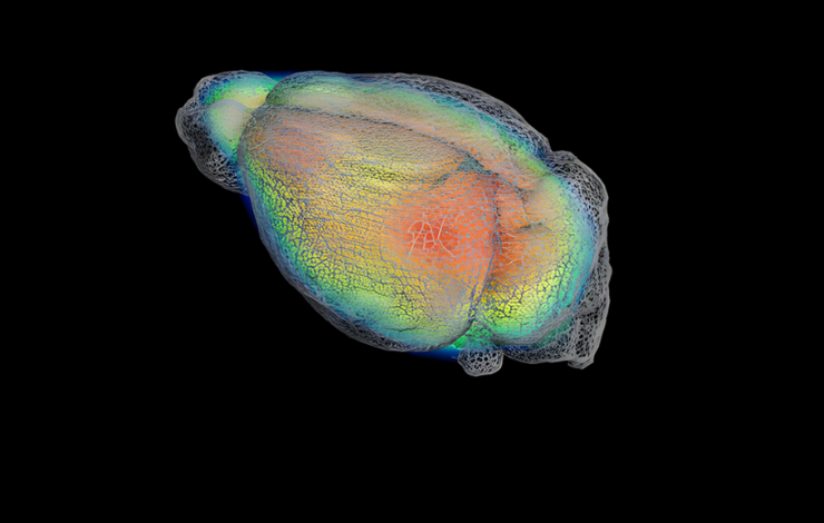 L'imagerie TEP éclaire l’action de la kétamine sur la dépression