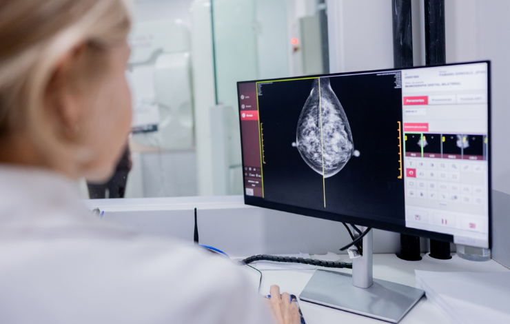 Cancer du sein : l’épigénome au cœur de la résistance aux chimiothérapies