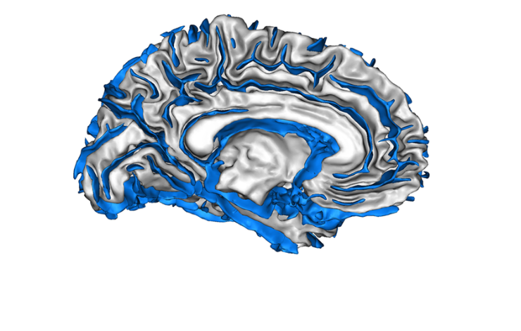 Comment relier génétique et plissement du cortex cérébral ?