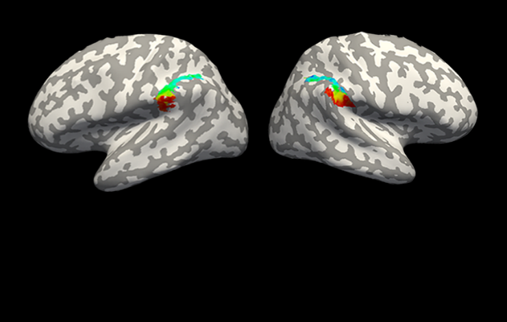 Comment le cerveau traite-t-il la représentation des nombres entiers et des fractions ?